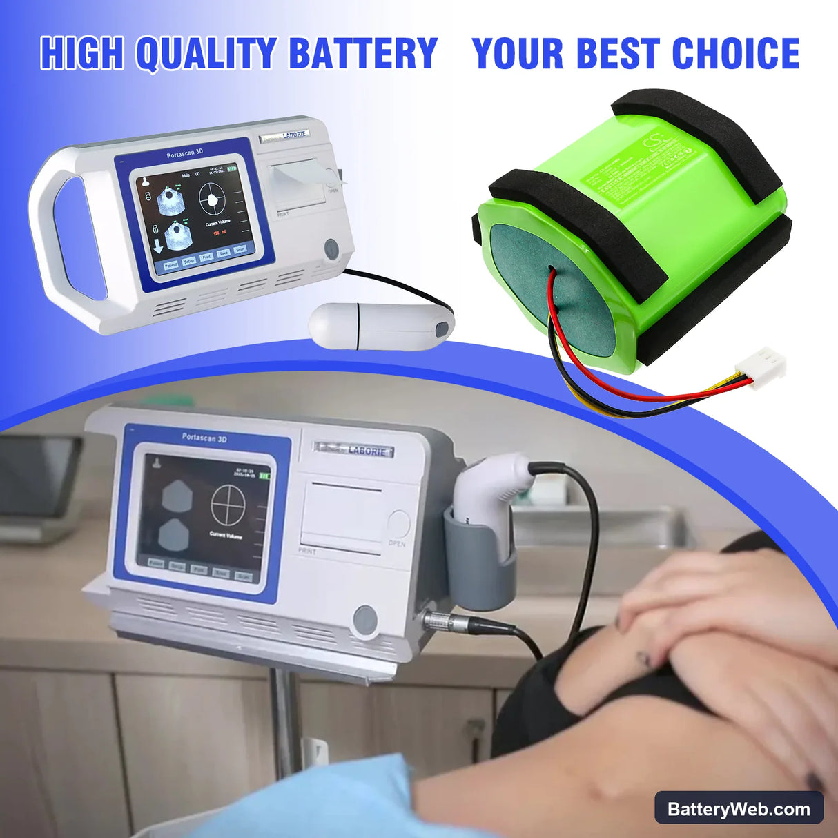 GE Portascan Bladder Scanner PA00141 Replacement Battery, 12V, 3600mAh, Ni-MH 6